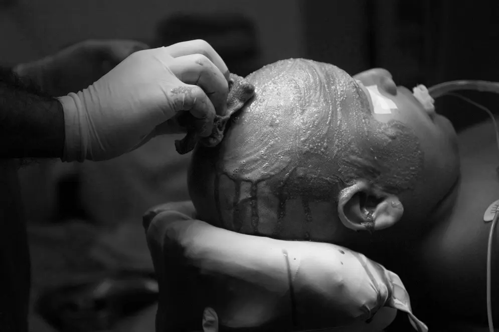 international-neurosurgical-childrens-association-14